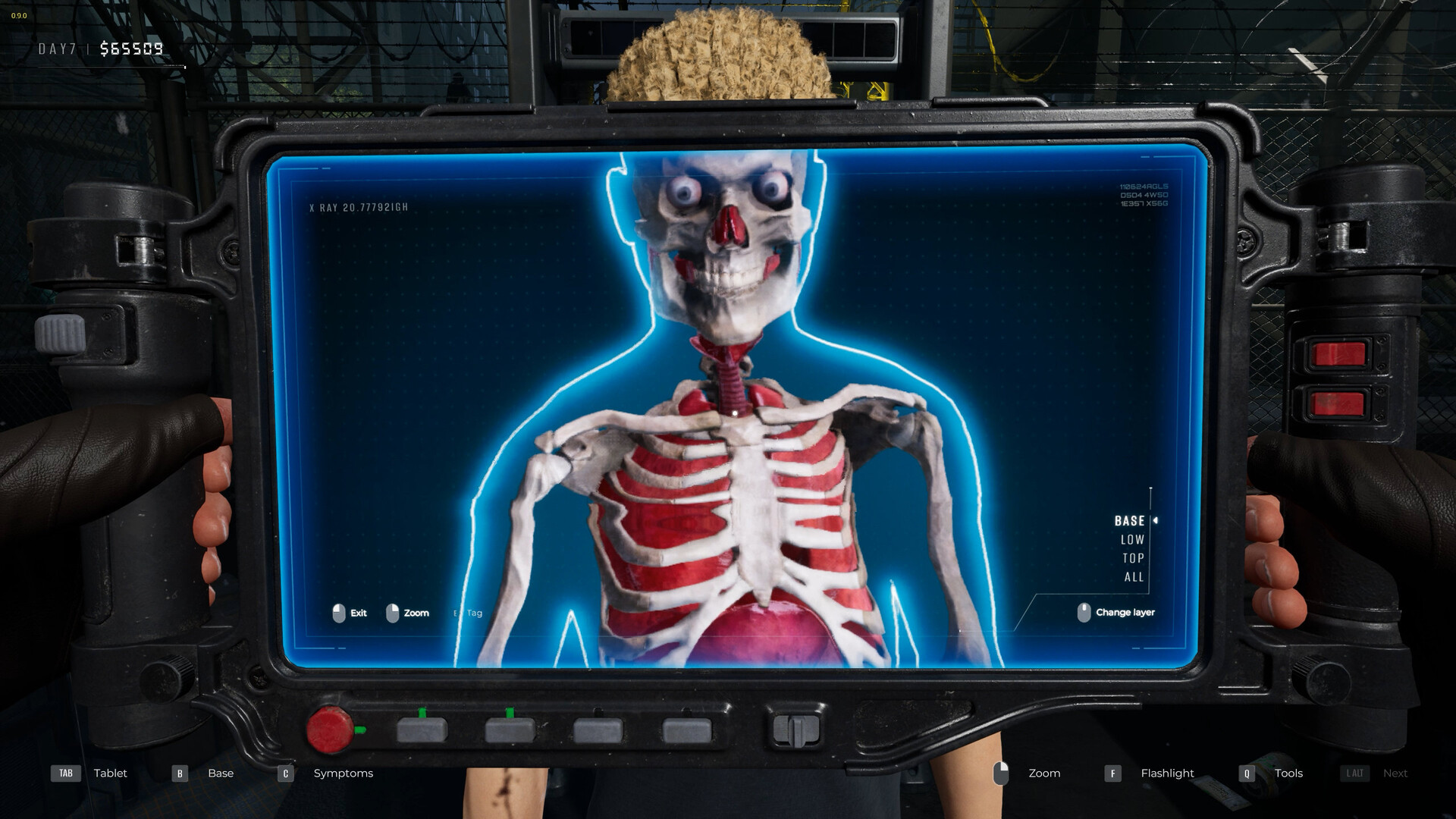 检疫区最后一站